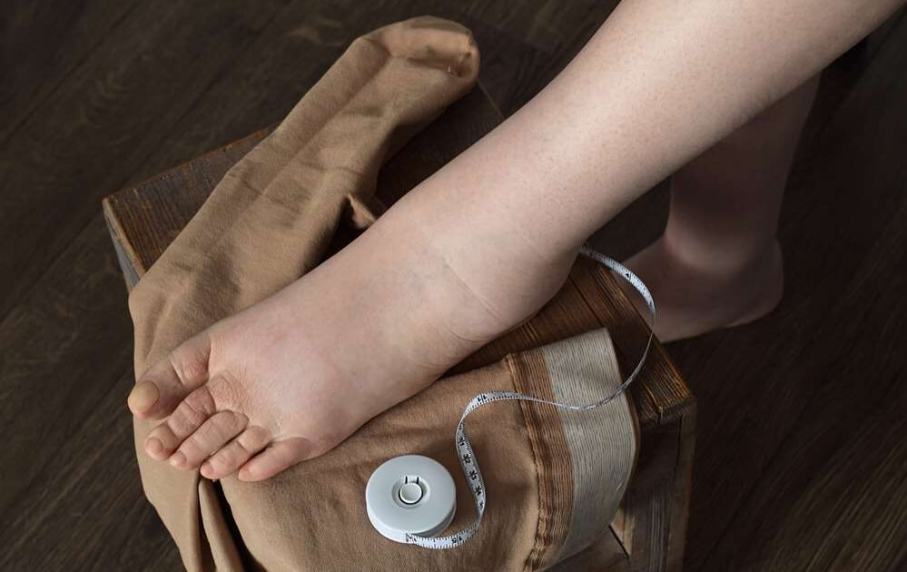 lenjerie de compresie terapie limfedem